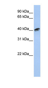 ACTR1A antibody LS-C102773 Western blot of MCF7 cell lysate.
