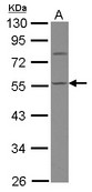 Sample (30 ug of whole cell lysate) A: HepG2 10% SDS PAGE CASQ1 antibody diluted at 1:1000
