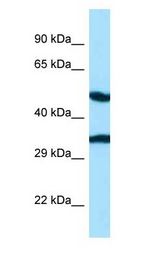 CASQ2 / Calsequestrin 2 antibody Western Blot of Fetal Heart.