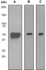 Fig 1. Western blot analysis on (A) human heart, (B) mouse heart, and (C) rat heart lysates using anti-Calsequestrin-2 antibody.
