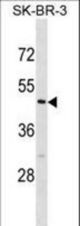 CASQ2 Antibody western blot of SK-BR-3 cell line lysates (35 ug/lane). The CASQ2 antibody detected the CASQ2 protein (arrow).