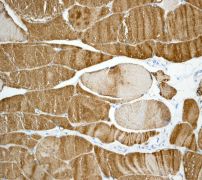 IHC of paraffin-embedded human skeletal muscles using anti-Calsequestrin-2 antibody.