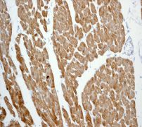 IHC of paraffin-embedded human cardiac muscles using anti-Calsequestrin-2 antibody.