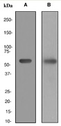 Western blot analysis on (A) human heart and (B) human skeletal muscle lysates using anti-Calsequestrin-2 antibody.