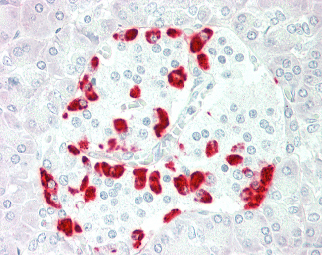 Human Pancreas: Formalin-Fixed, Paraffin-Embedded (FFPE)