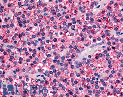 Anti-CASR antibody LS-A1426 IHC of human parathyroid. Immunohistochemistry of formalin-fixed, paraffin-embedded tissue after heat-induced antigen retrieval.