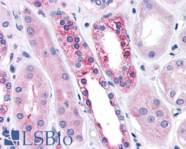 Anti-CASR/Calcium Sensing Receptor antibody IHC of human kidney, diabetes. Immunohistochemistry of formalin-fixed, paraffin-embedded tissue after heat-induced antigen retrieval.