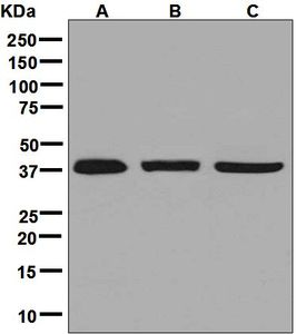 Western blot analysis on (A) Jurkat, (B) HUVEC, and (C) MCF-7 cell lysates using anti-ARP2 antibody.
