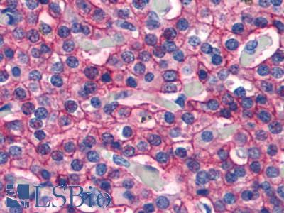 Anti-CASR antibody LS-A1425 IHC of human parathyroid. Immunohistochemistry of formalin-fixed, paraffin-embedded tissue after heat-induced antigen retrieval.