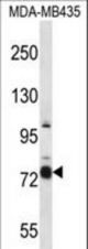 CASS4 Antibody western blot of MDA-MB435 cell line lysates (35 ug/lane). The CASS4 antibody detected the CASS4 protein (arrow).