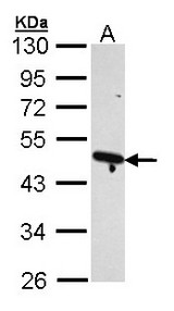 Sample (30 ug of whole cell lysate). A: H1299. 10% SDS PAGE. ACTR2 antibody diluted at 1:1000.