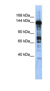 CASZ1 antibody LS-C109748 Western blot of Transfected 293T cell lysate.
