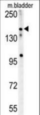 CASZ1 Antibody western blot of mouse bladder tissue lysates (15 ug/lane). The CASZ1 antibody detected CASZ1 protein (arrow).