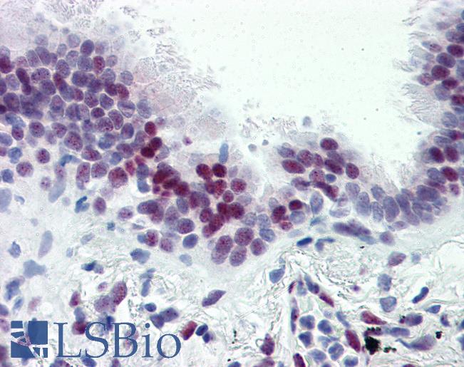 Anti-CASZ1 antibody IHC of human lung. Immunohistochemistry of formalin-fixed, paraffin-embedded tissue after heat-induced antigen retrieval. Antibody LS-B2838 concentration 5 ug/ml.