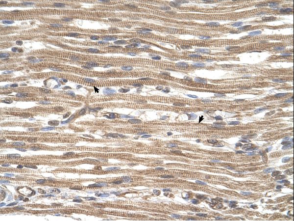 ACTR2 / ARP2 antibody LS-C80790 was used in IHC to stain formalin-fixed, paraffin-embedded human muscle.