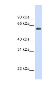 CAT / Catalase antibody LS-C107873 Western blot of Fetal Heart lysate.
