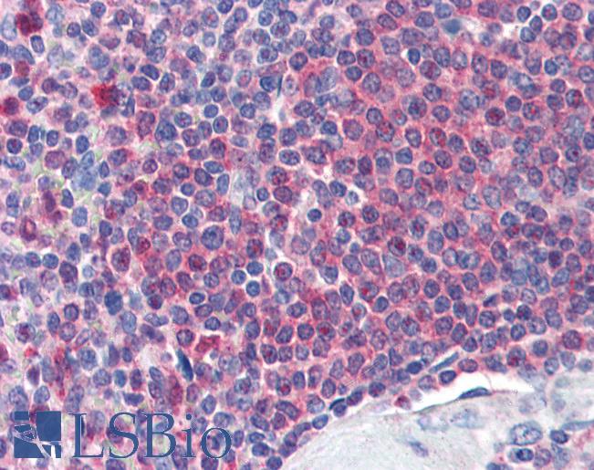 Anti-Catalase antibody IHC of human spleen. Immunohistochemistry of formalin-fixed, paraffin-embedded tissue after heat-induced antigen retrieval. Antibody LS-B3014 concentration 2 ug/ml.