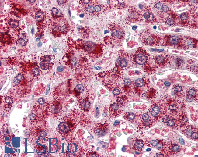 Anti-Catalase antibody IHC of human liver. Immunohistochemistry of formalin-fixed, paraffin-embedded tissue after heat-induced antigen retrieval. Antibody LS-B3014 concentration 2 ug/ml.