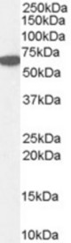 Western blot of human kidney lysate