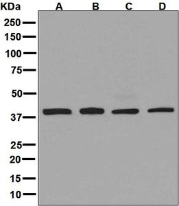Western blot analysis on (A) Jurkat, (B) HUVEC, (C) MCF-7, and (D) HeLa cell lysates using anti-ARP2 antibody.