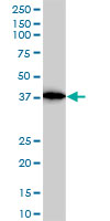 ACTR2 monoclonal antibody (M01), clone 1B10-C4. Western blot of ACTR2 expression in A-431.
