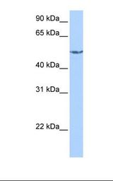 HepG2 cell lysate. Antibody concentration: 1.0 ug/ml. Gel concentration: 12%.