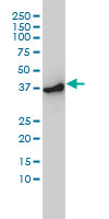 ACTR2 monoclonal antibody (M01), clone 1B10-C4 Western blot of ACTR2 expression in HeLa NE.