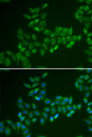 Immunofluorescence analysis of HeLa cell using CRAT antibody. Blue: DAPI for nuclear staining.