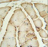 CRAT Antibody IHC of formalin-fixed and paraffin-embedded human Skeletal muscle followed by peroxidase-conjugated secondary antibody and DAB staining.