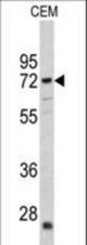 Western blot of CRAT antibody in CEM cell line lysates (35 ug/lane). CRAT (arrow) was detected using the purified antibody.