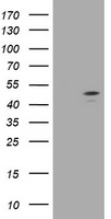 HEK293T cells were transfected with the pCMV6-ENTRY control (Left lane) or pCMV6-ENTRY C2orf62 (Right lane) cDNA for 48 hrs and lysed. Equivalent amounts of cell lysates (5 ug per lane) were separated by SDS-PAGE and immunoblotted with anti-C2orf62.