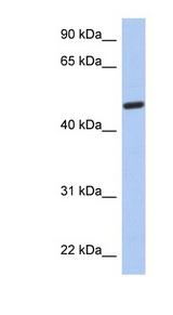 C2orf62 antibody LS-C111742 Western blot of Fetal Brain lysate.