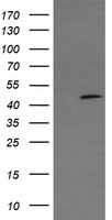 HEK293T cells were transfected with the pCMV6-ENTRY control (Left lane) or pCMV6-ENTRY C2orf62 (Right lane) cDNA for 48 hrs and lysed. Equivalent amounts of cell lysates (5 ug per lane) were separated by SDS-PAGE and immunoblotted with anti-C2orf62.