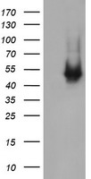 HEK293T cells were transfected with the pCMV6-ENTRY control (Left lane) or pCMV6-ENTRY C2orf62 (Right lane) cDNA for 48 hrs and lysed. Equivalent amounts of cell lysates (5 ug per lane) were separated by SDS-PAGE and immunoblotted with anti-C2orf62.
