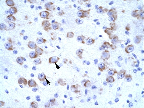 CATSPER2 antibody LS-C31616 was used in IHC to stain formalin-fixed, paraffin-embedded human brain.