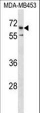 CATSPER2 Antibody western blot of MDA-MB453 cell line lysates (35 ug/lane). The CATSPER2 antibody detected the CATSPER2 protein (arrow).