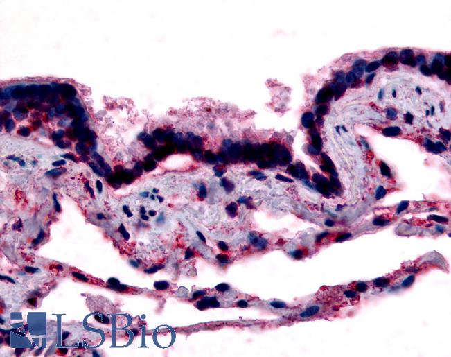 Anti-CAV1 / Caveolin antibody LS-A2872 IHC of human respiratory epithelium, bronchial smooth muscle, and alveoli. Immunohistochemistry of formalin-fixed, paraffin-embedded tissue after heat-induced antigen retrieval.