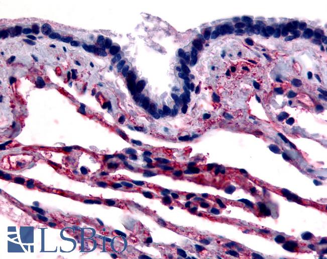 Anti-CAV1 / Caveolin antibody LS-A2870 IHC of human respiratory epithelium and alveoli. Immunohistochemistry of formalin-fixed, paraffin-embedded tissue after heat-induced antigen retrieval.