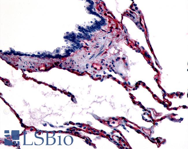 Anti-CAV1 / Caveolin antibody LS-A2869 IHC of human respiratory epithelium, bronchial smooth muscle, and alveoli. Immunohistochemistry of formalin-fixed, paraffin-embedded tissue after heat-induced antigen retrieval.