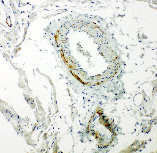 CAV2 / Caveolin 2 antibody. IHC(P): Rat Cardiac Muscle Tissue.