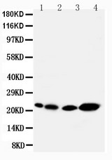 WB of CAV2 / Caveolin 2 antibody. All lanes: Anti-CAV2 at 0.5ug/ml. Lane 1: Rat Heart Tissue Lysate at 40ug. Lane 2: Rat lung Tissue Lysate at 40ug. Lane 3: HELA Whole Cell Lysate at 40ug. Lane 4: A431 Whole Cell Lysate at 40ug. Predicted bind size: 17KD. Observed bind size: 22KD.