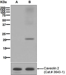 Western blot analysis on HUVEC cell lysates using anti-Phospho-Caveolin 2 (pY19) antibody. Cells were either (A) untreated (B) treated with pervanadate.