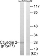 Western blot of extracts from HepG2 cells treated with EGF 200ng/ml 5' , using Caveolin 2 (Phospho-Tyr27) Antibody. The lane on the right was incubated with synthetic peptide.