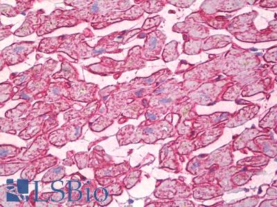 Anti-CAV2 / Caveolin 2 antibody IHC of human heart. Immunohistochemistry of formalin-fixed, paraffin-embedded tissue after heat-induced antigen retrieval. Antibody LS-B6770 dilution 1:50.