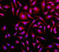 Immunofluorescent staining of HeLa cells using anti-Caveolin 2 antibody (LS-B6770).