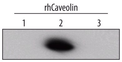Detection of Human Caveolin-2 by Western Blot. Western blot shows recombinant human Caveolin-1, Caveolin-2 and Caveolin-3 (5 ng/lane). PVDF membrane was probed with 1 ug/ml Goat Anti-Human/Mouse/Rat Caveolin-2 Antigen Affinity-purified Polyclonal Antibody followed by HRP-conjugated Anti-Goat IgG Secondary Antibody. A specific band for Caveolin-2 was detected at approximately 22 kD (as indicated). This experiment was conducted under reducing conditions.