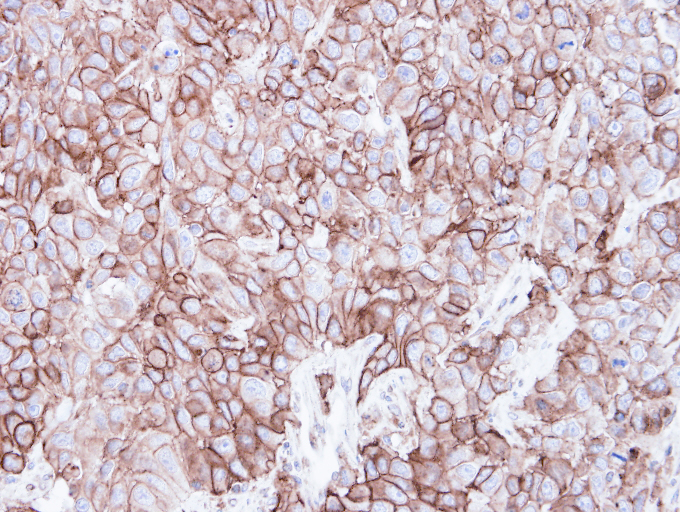 IHC of paraffin-embedded FaDu xenograft using Caveolin 2 antibody at 1:500 dilution.