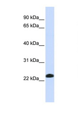 CAV2 / Caveolin 2 antibody LS-C102834 Western blot of Fetal Lung lysate. Antibody concentration 1 ug/ml.