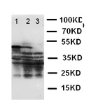 WB of CAV3 / Caveolin 3 antibody. Lane 1: U87 Cell Lysate. Lane 2: HELA Cell Lysate. Lane 3: MCF-7 Cell Lysate.