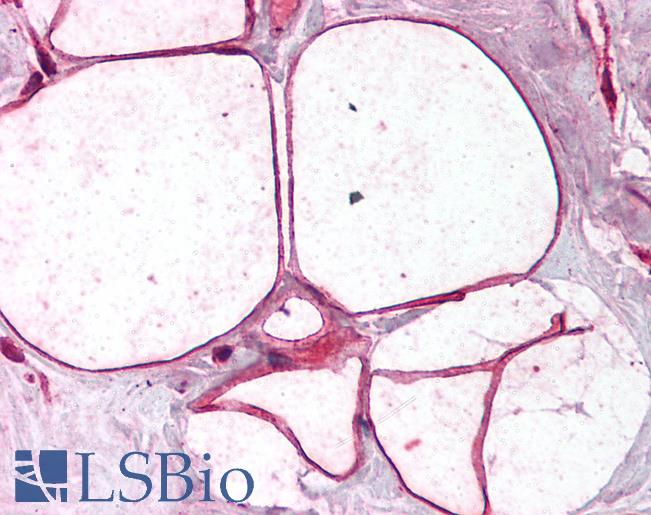 Anti-CAV3 / Caveolin 3 antibody IHC of human breast, adipocytes. Immunohistochemistry of formalin-fixed, paraffin-embedded tissue after heat-induced antigen retrieval. Antibody LS-B1589 concentration 5 ug/ml.
